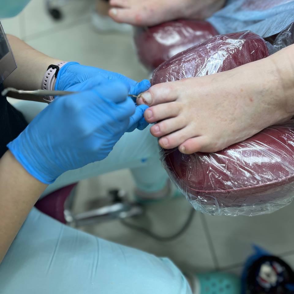 парамедицинский педикюр