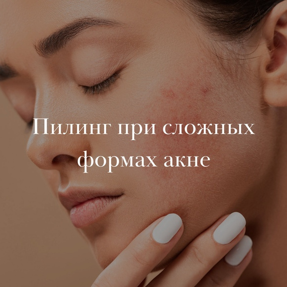 Пилинг при сложных формах акне