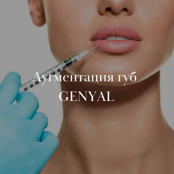 Аугментация губ GENYAL Lyps (Италия)