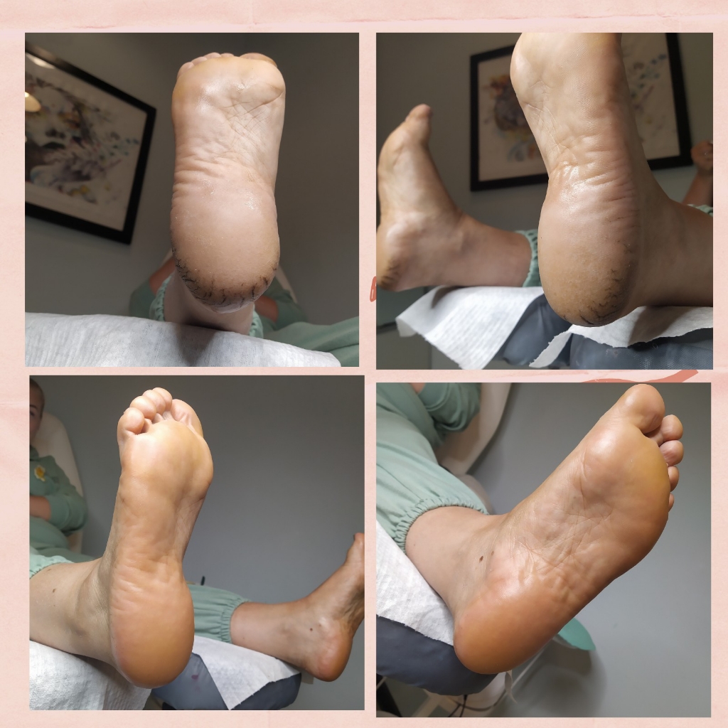 Педикюр Аппаратный/Смарт/комбинированный