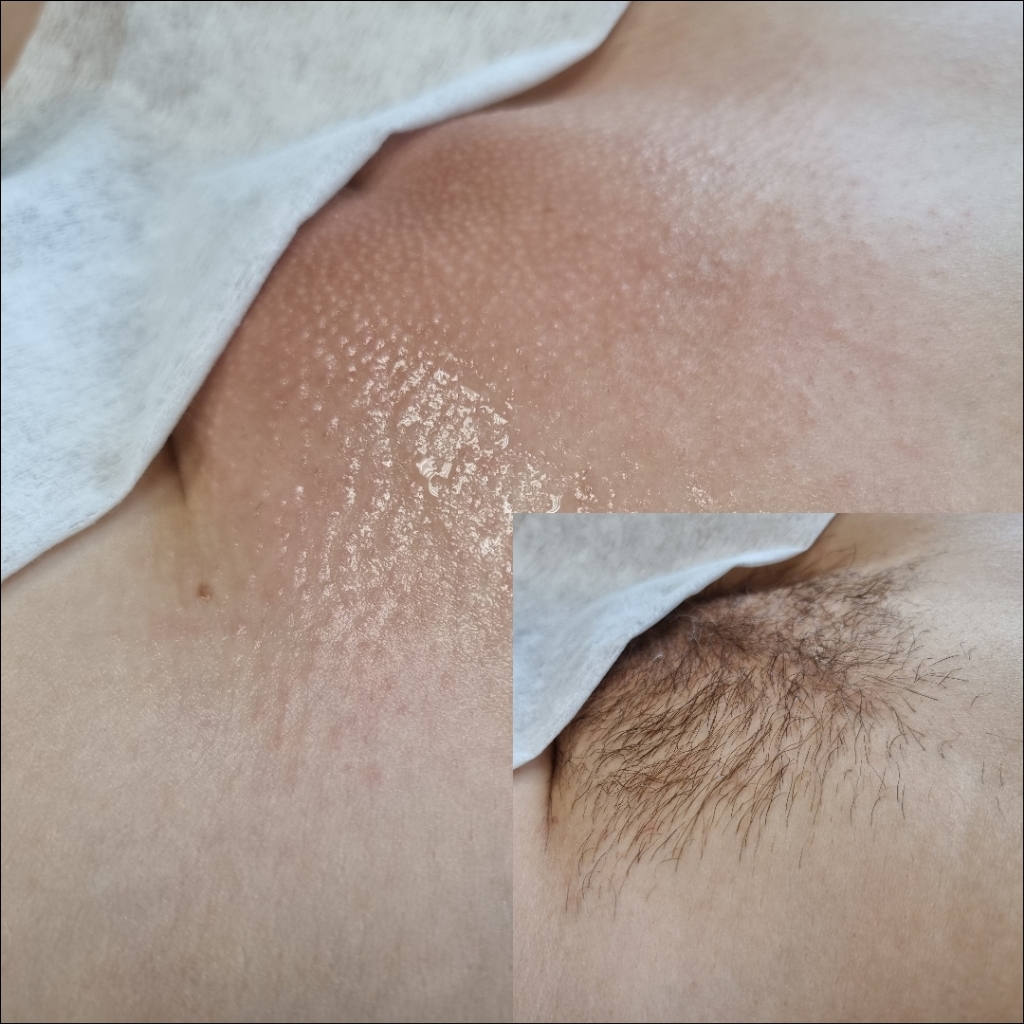 Глубокое бикини