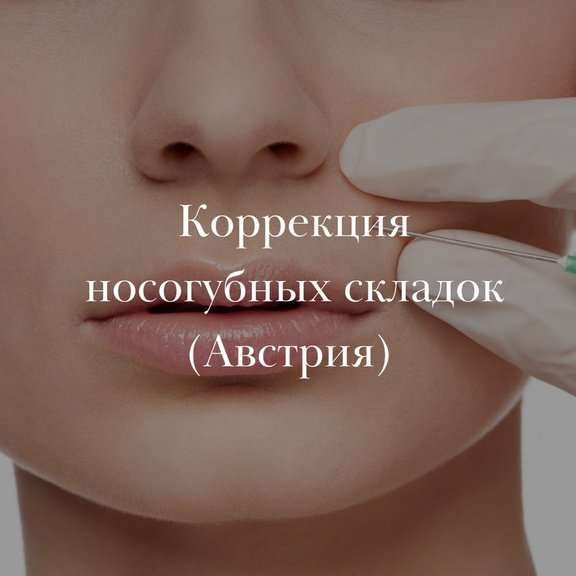 Коррекция носогубных складок (Австрия)