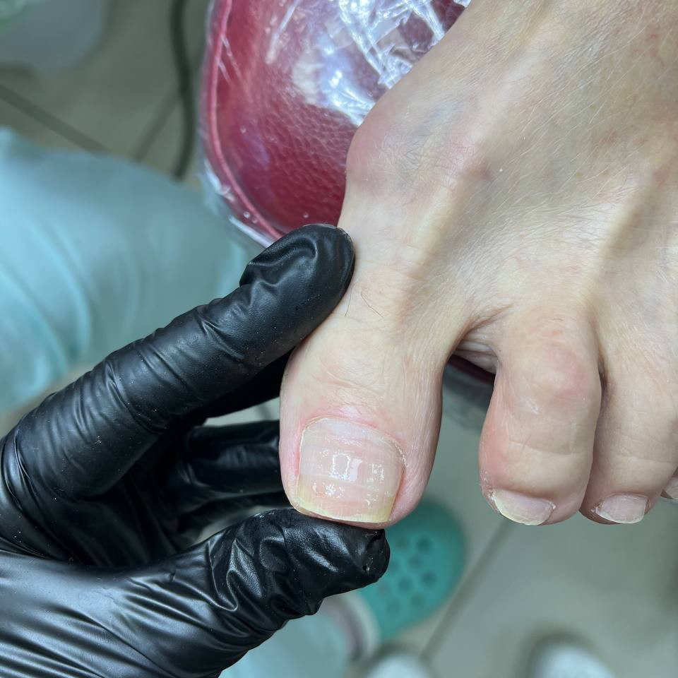 титановая нить/Light system