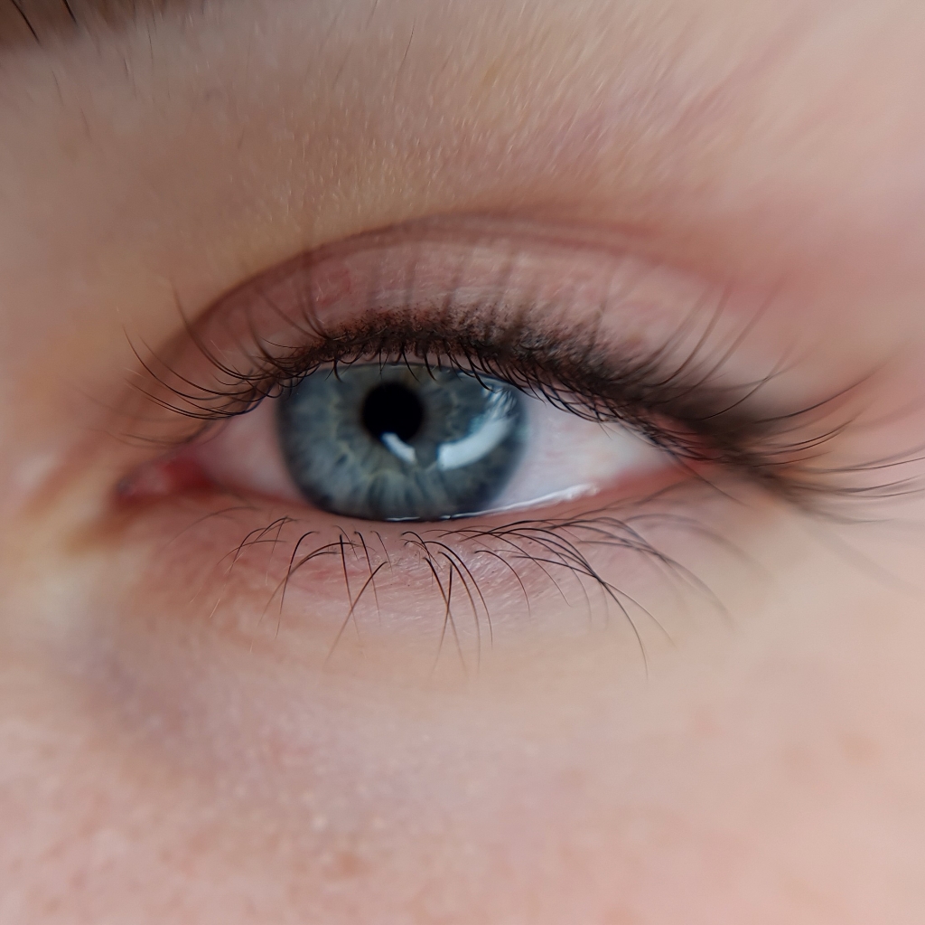 Веки, первый сеанс, "пушистая" межресничка