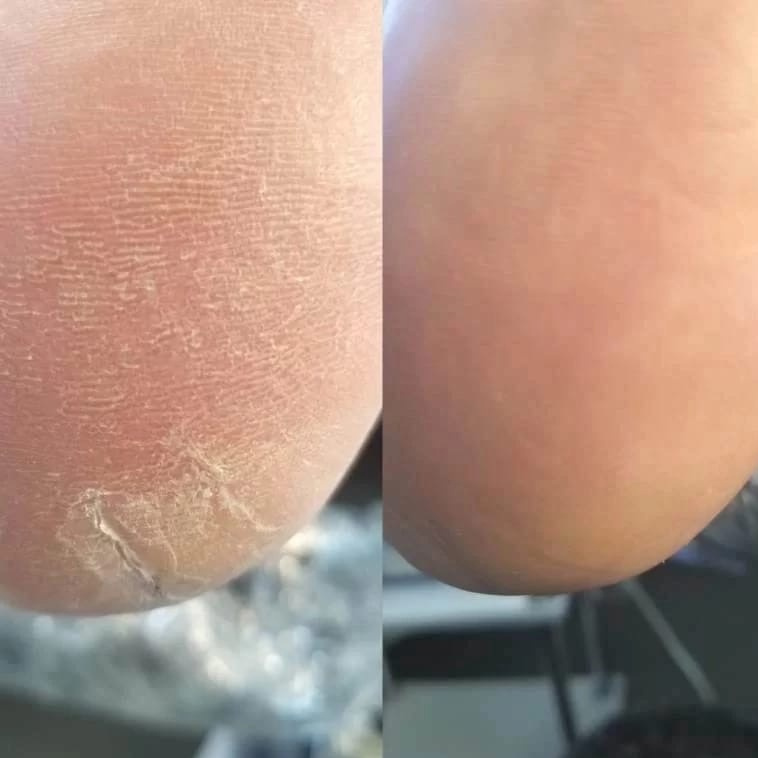 Педикюр Smart полный без покрытия