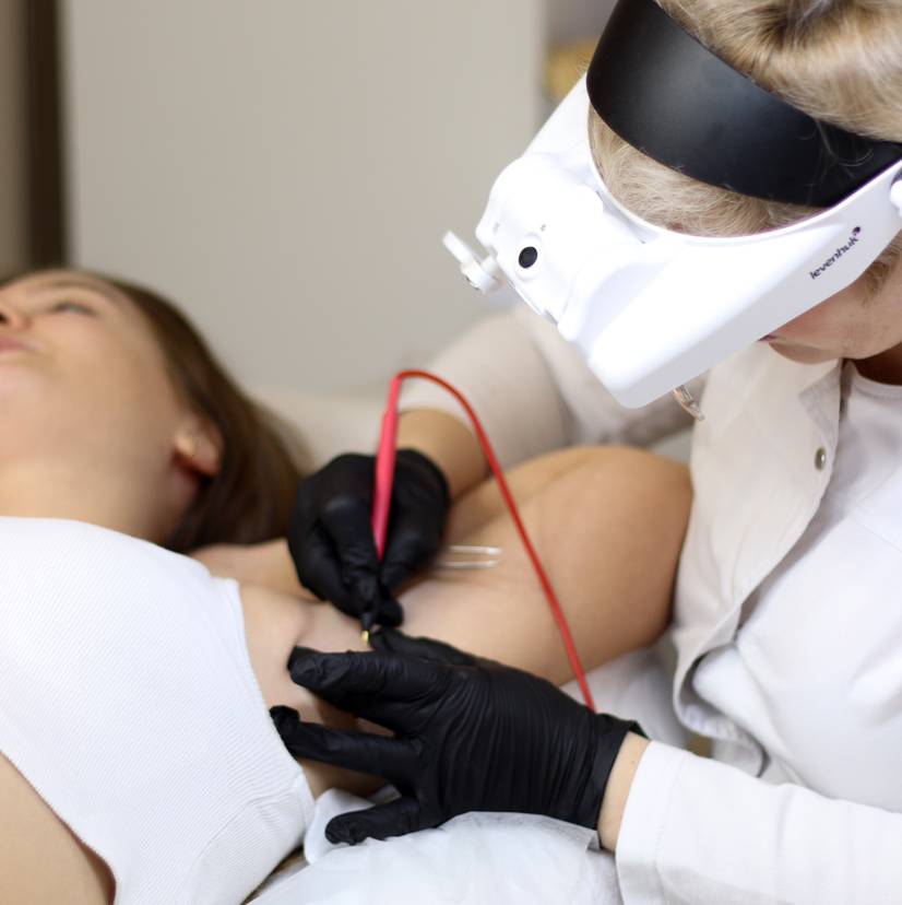 Абонемент «Комфорт 140»/Электроэпиляция