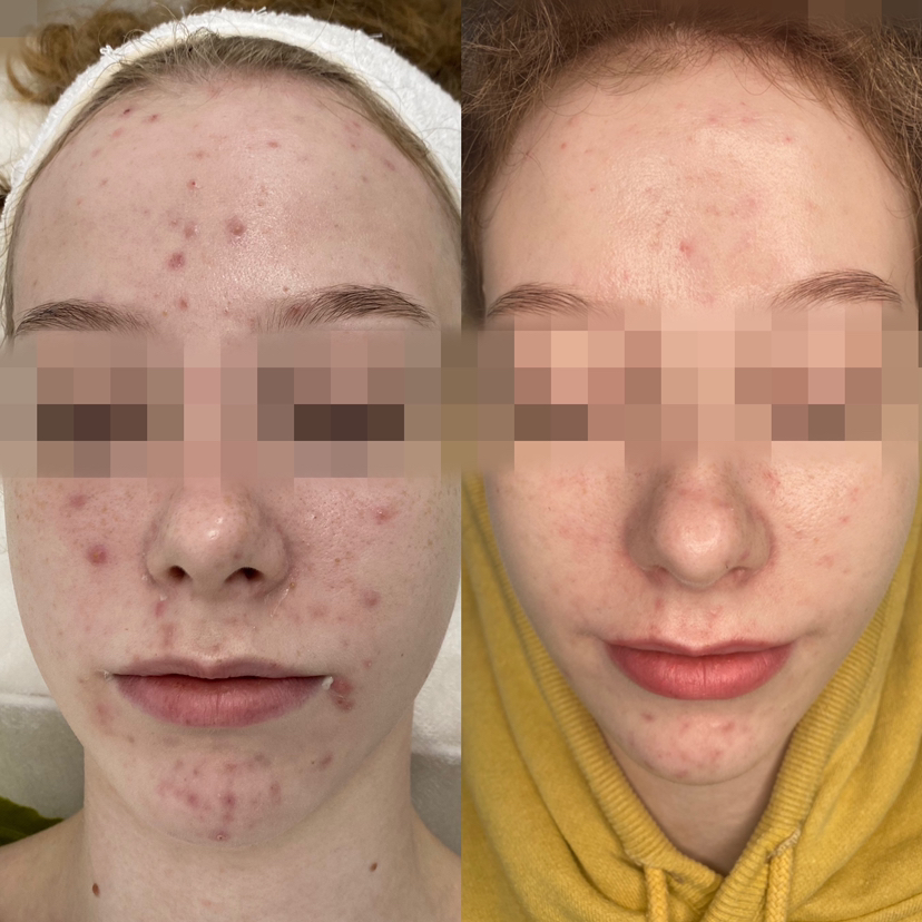 Знакомство с кожей