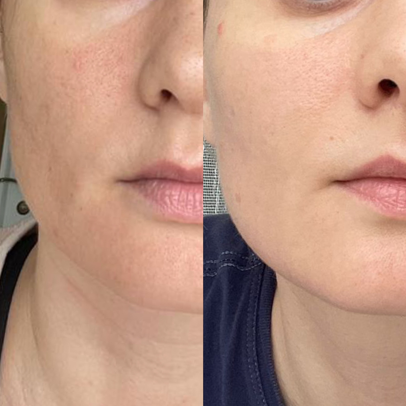 Консультация по подбору домашнего ухода (стоимость косметики в стоимость не входит)  Так же есть возможность онлайн подбора