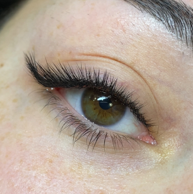 Классическое наращивание (1D)