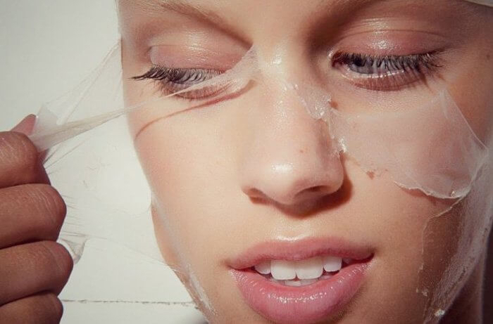 Пилинг Джесснера