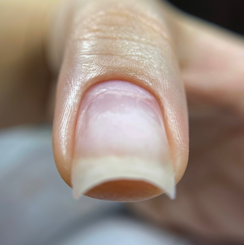 Ремонт ногтя