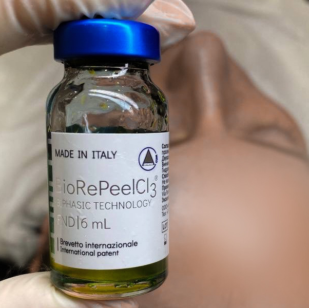 Пилинг для лица и шеи (УЗ-чистка в подарок)