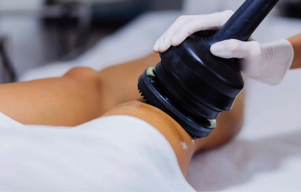 Субдермальный массаж(вибро) От коленей до живота