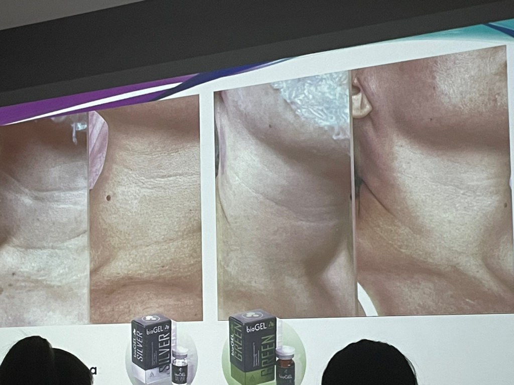 Протокол «Молодая шея»