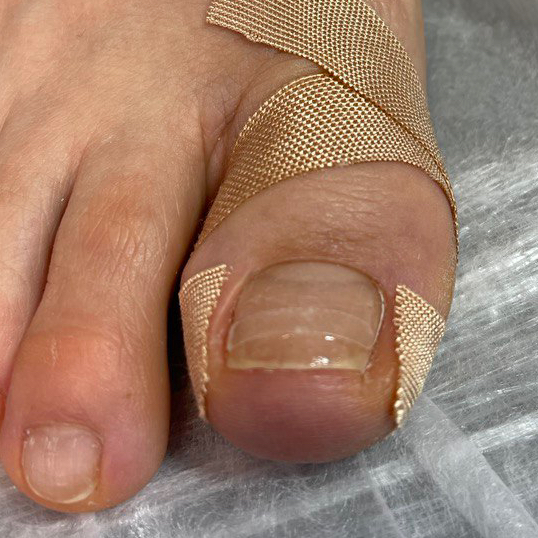 Установка системы