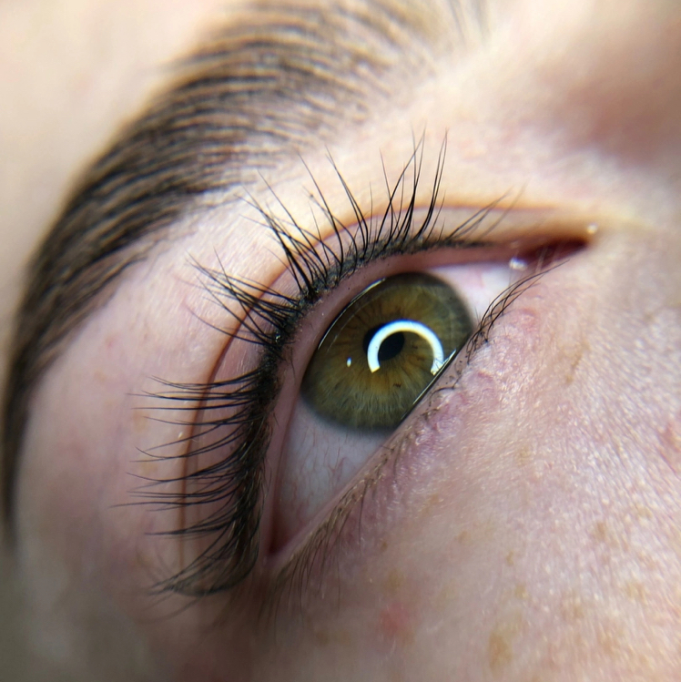 Коррекция ПМ межресничка