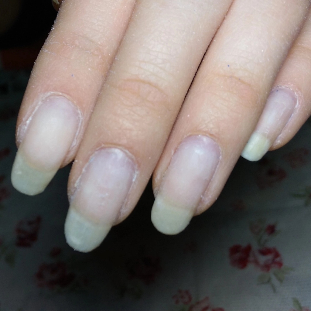 Снятие искуственного покрытия