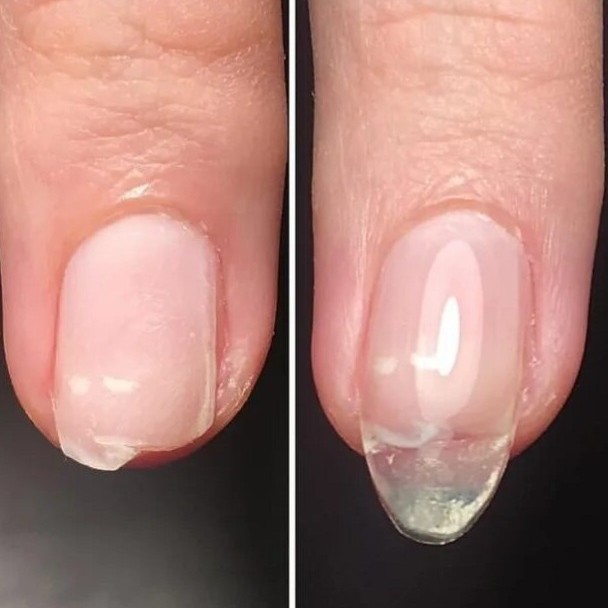 Наращивание сломанного ногтя