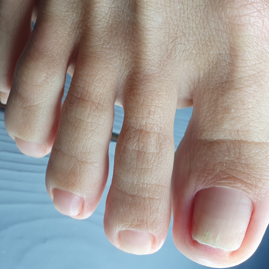 Мини педикюр, (аппаратная обработка пальчиков или ступни)