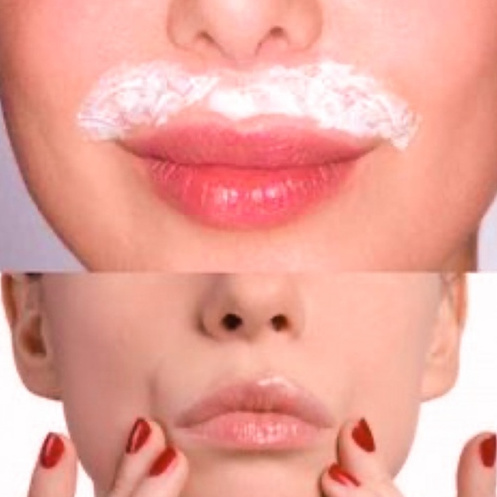 Удаление нежелательных волосков на лице (одна зона)