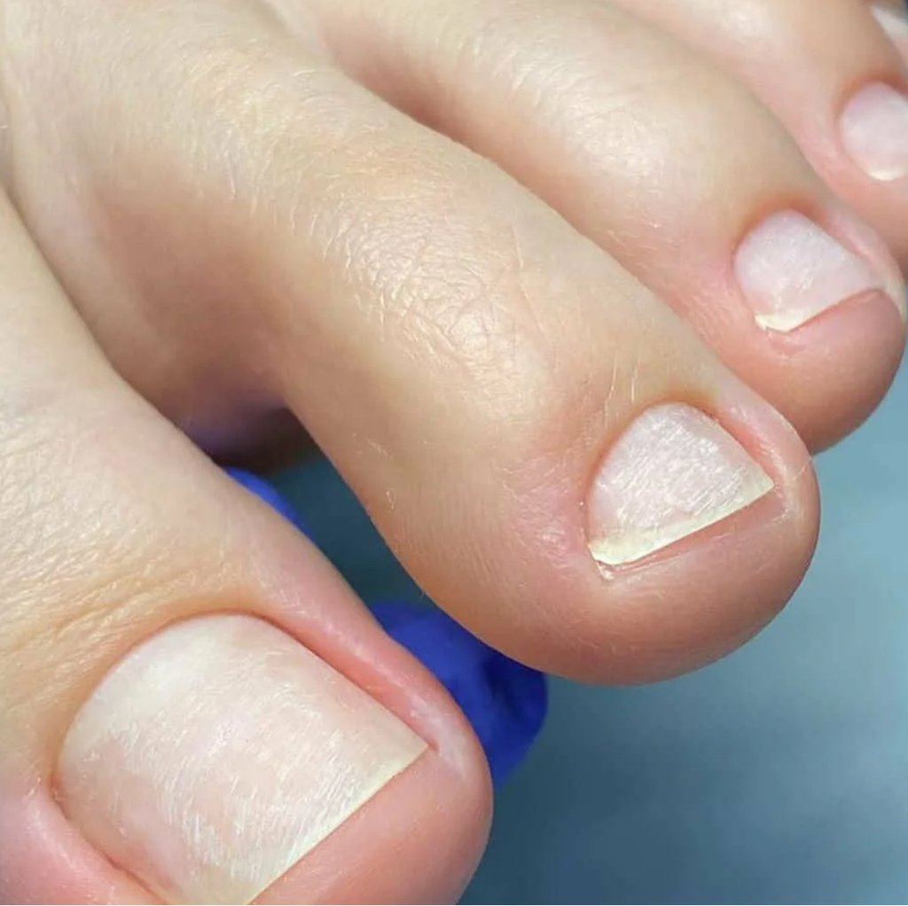 Педикюр пальчиков Мастер 1 категории