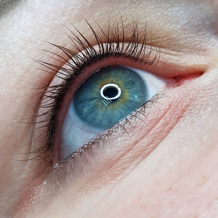 коррекция межресничка