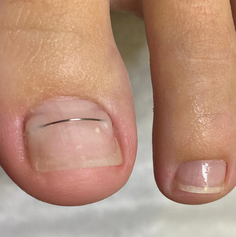 Титановая нить