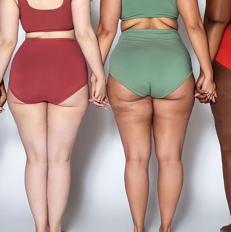 Антицеллюлитный массаж