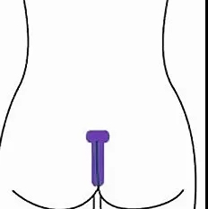 Межъягодичная впадина