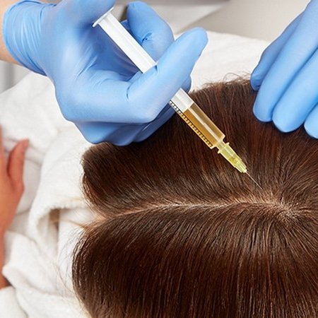 Мезотерапия волосы