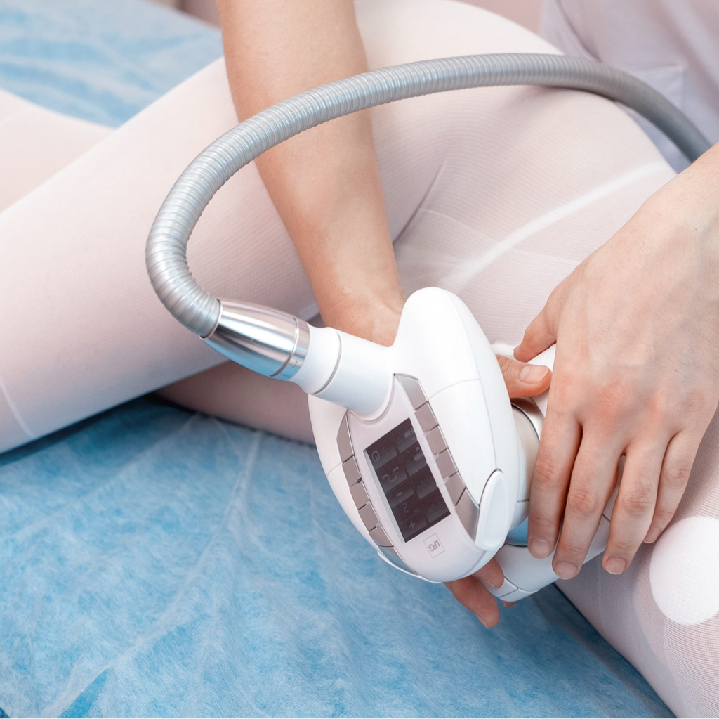 Lpg абонемент