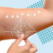 SMAS-лифтинг рук