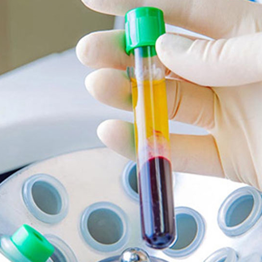 Плазмотерапия