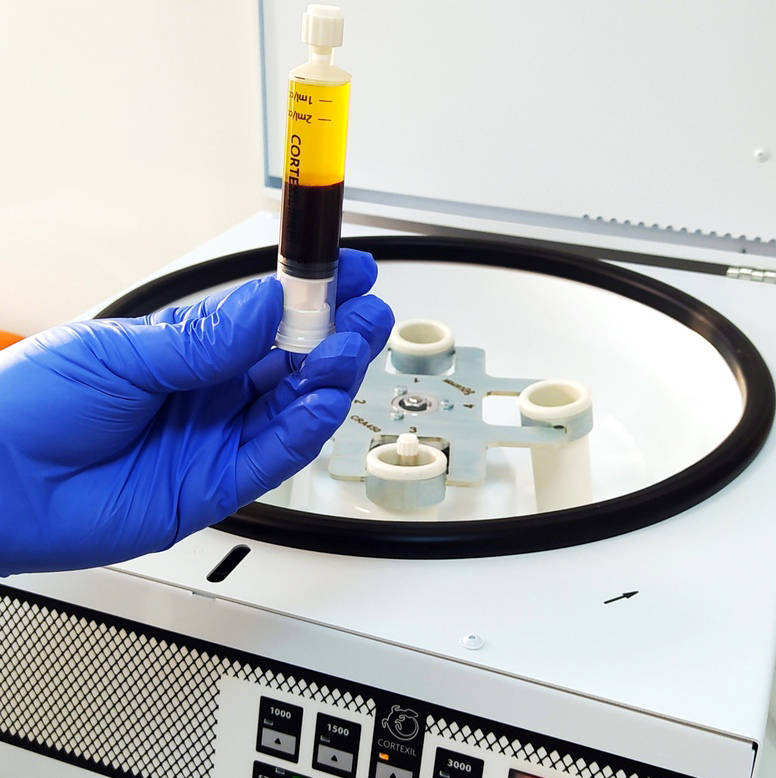 Prp-плазмолифтинг Cortexil