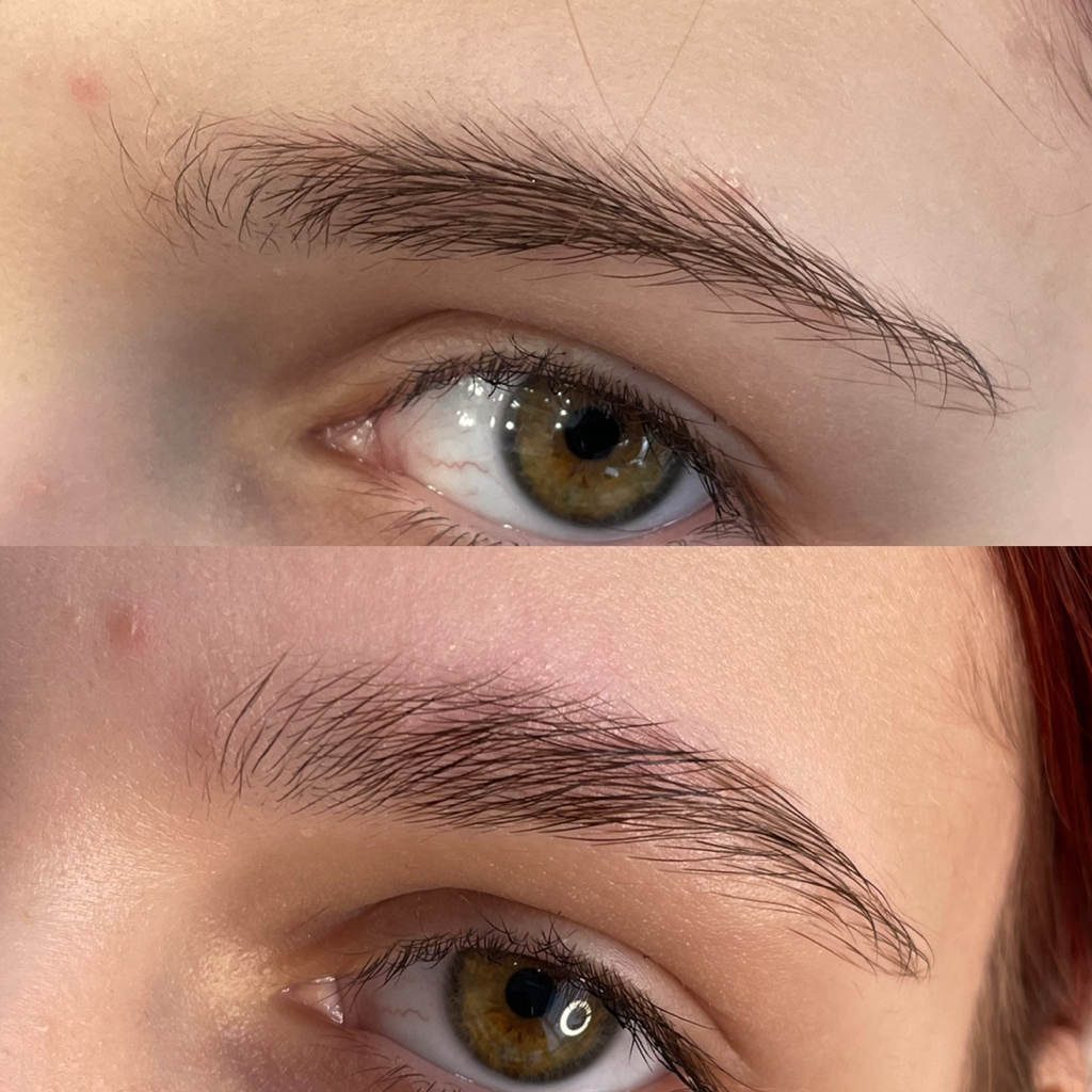 Подростковая коррекция