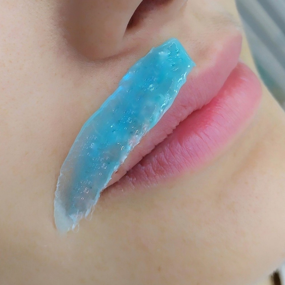 Удаление волосков на лице одна зона