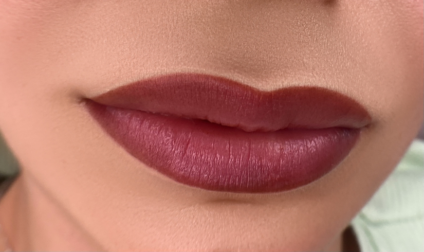 Коррекция губ