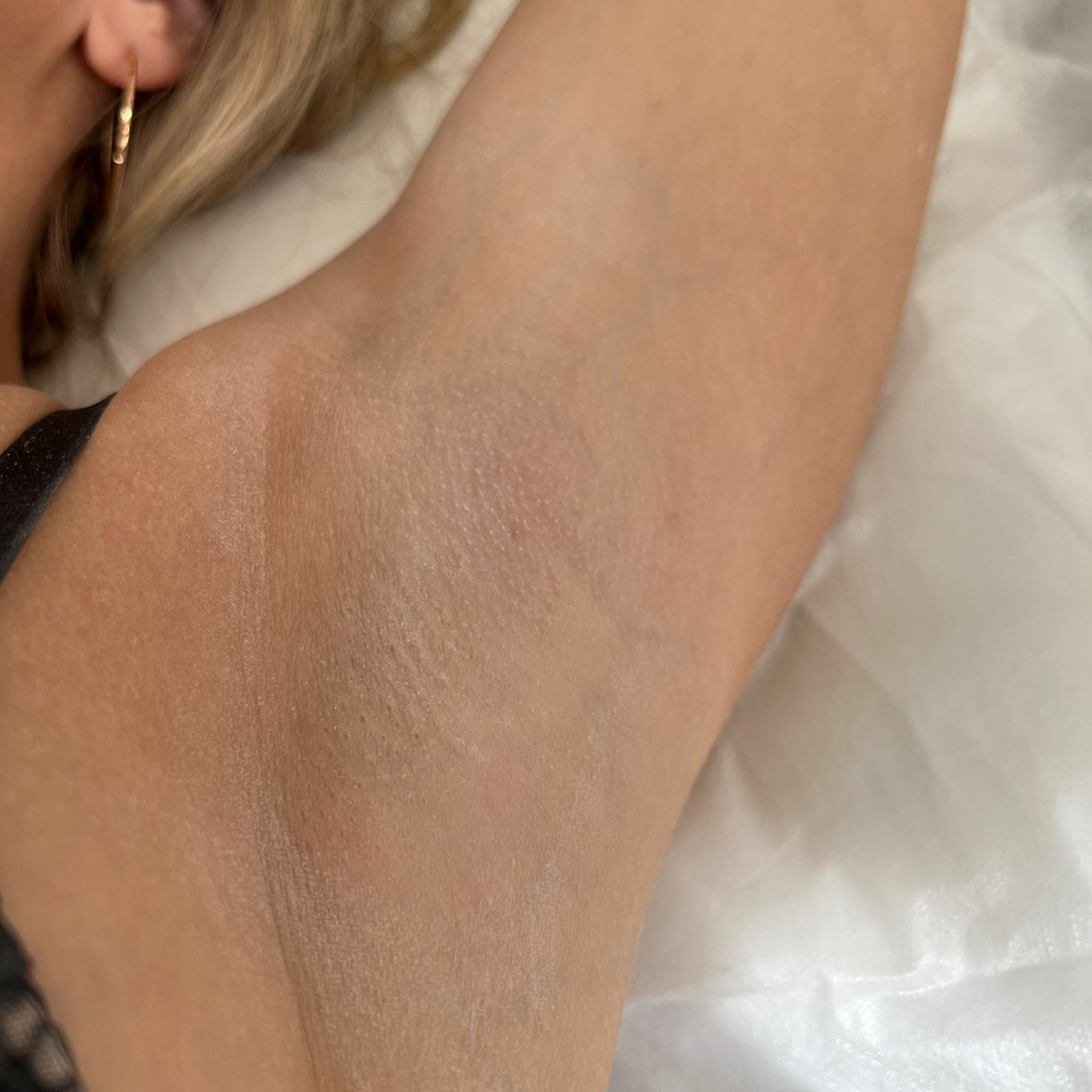 Подмышечные впадины