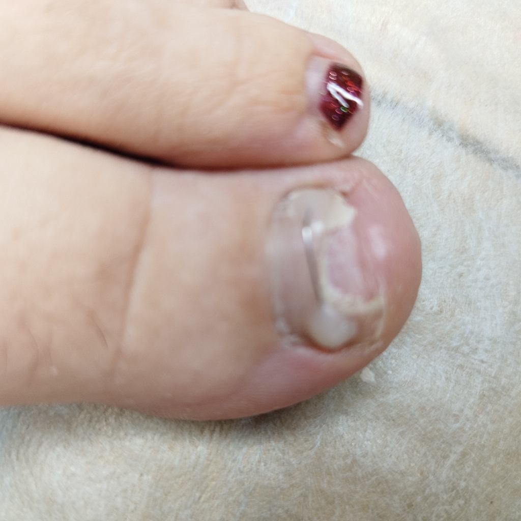 Титановоя нить