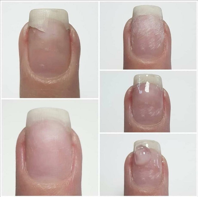 Ремонт (ЗА НОГОТЬ)