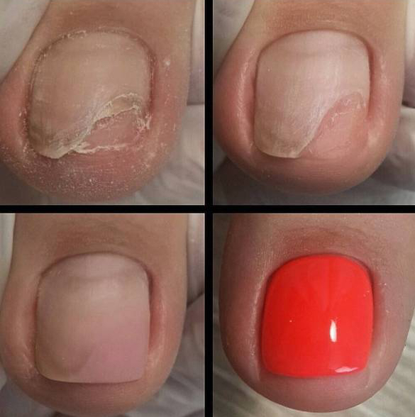 Ремонт (ЗА НОГОТЬ)