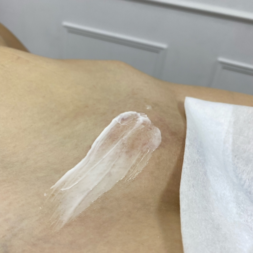 Бикини глубокое (САХАР)