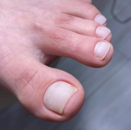 ПЕДИКЮР- эстетика  ✔️обработка пальчиков без дальнейшего покрытия Снятие +200 ₽