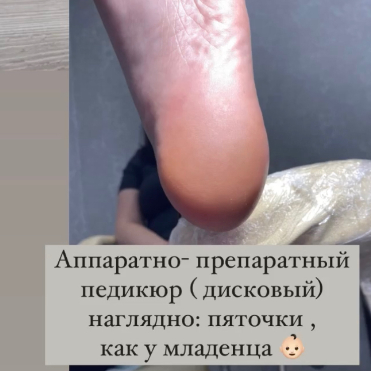ПЕДИКЮР гигиенический с обработкой стопы без покрытия   ✔️Пальчики + стопа без дальнейшего покрытия