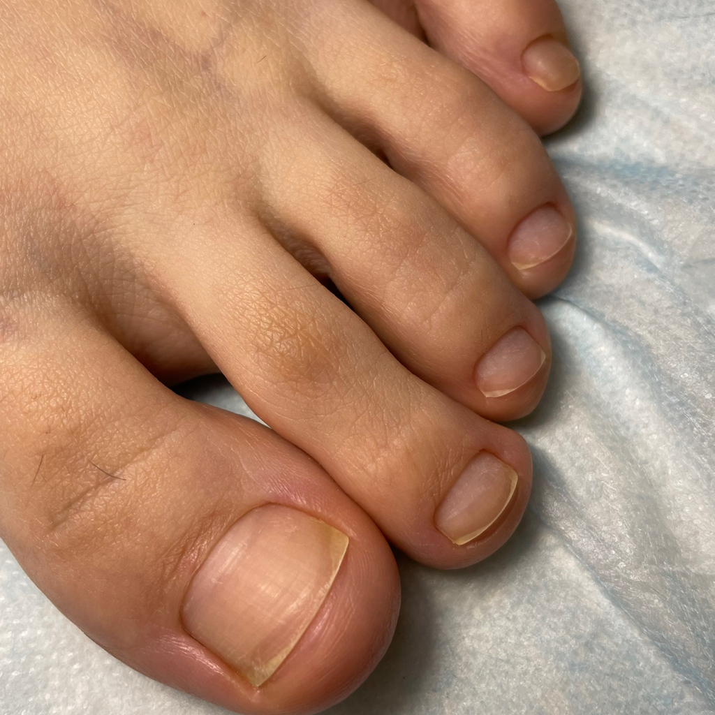 Smart - педикюр без покрытия   (Снятие без последующего покрытия 1000)