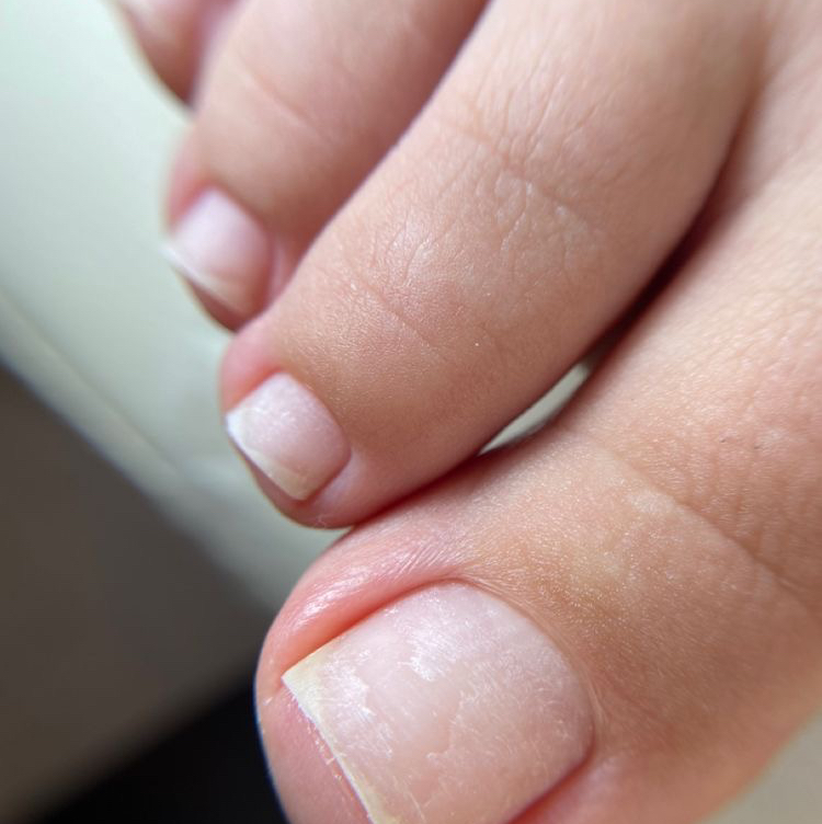 Гигиенический педикюр (пальчики)