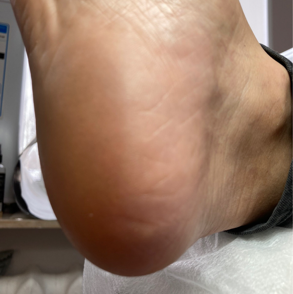 Обработка пяточки без обработки пальчиков без покрытия гель лаком