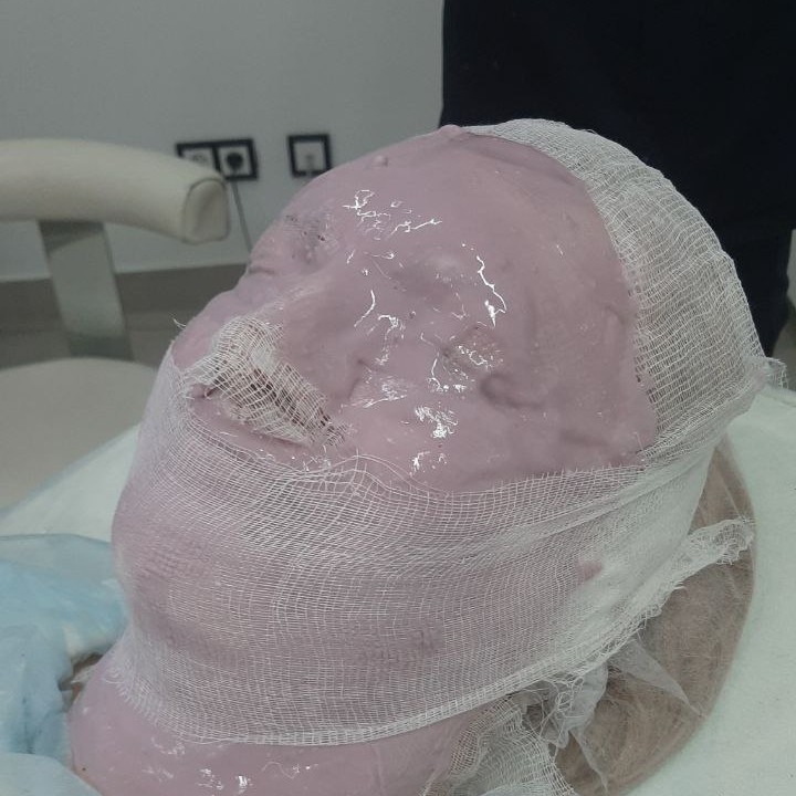 альгинатная маска