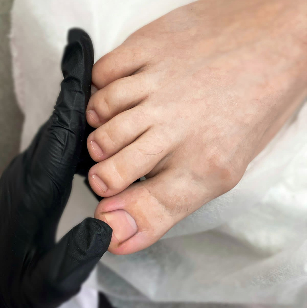 Педикюр женский(smart,комбинированный,аппаратный,кислотный)