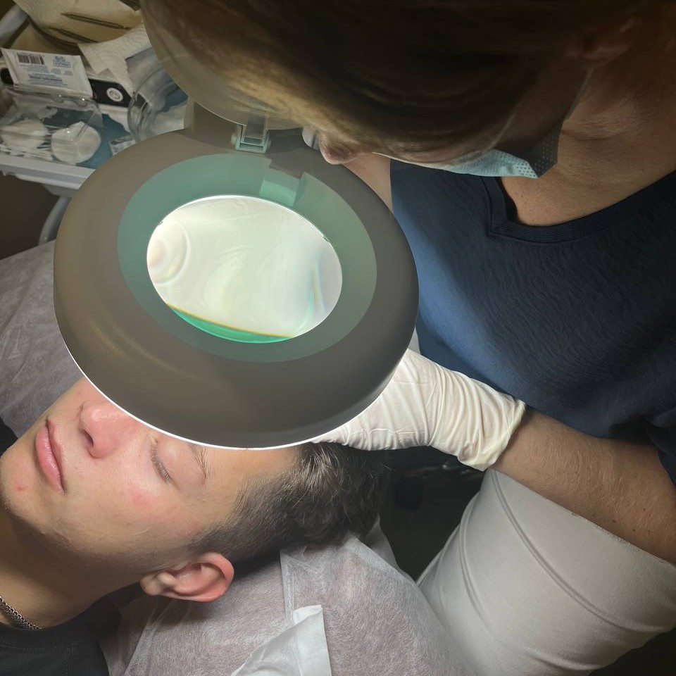 Комбинированная чистка лица + пилинг